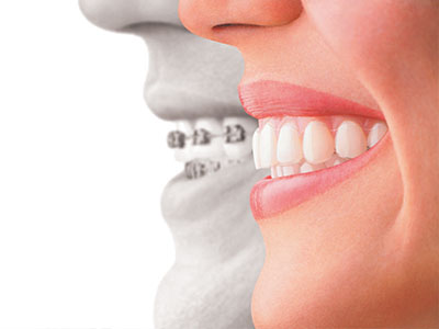 Darryl Lieberman, DDS   Associates | Veneers, Preventative Program and Dental Cleanings