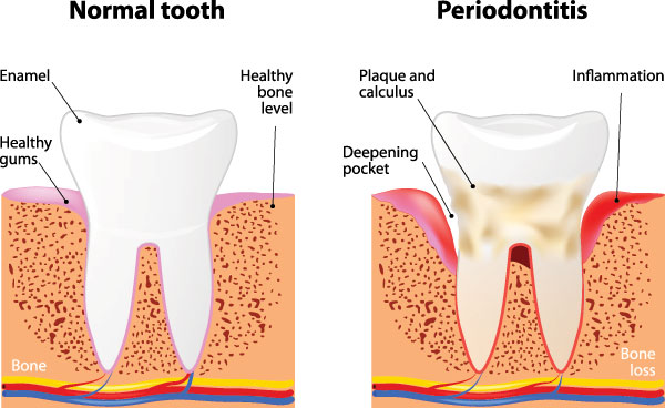 Darryl Lieberman, DDS   Associates | Crowns  amp  Caps, Dentures and Dental Cleanings