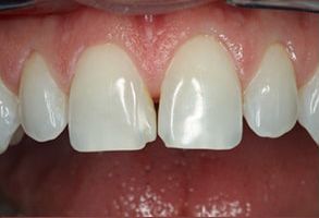 Darryl Lieberman, DDS   Associates | Dentures, Dental Cleanings and Invisalign reg 